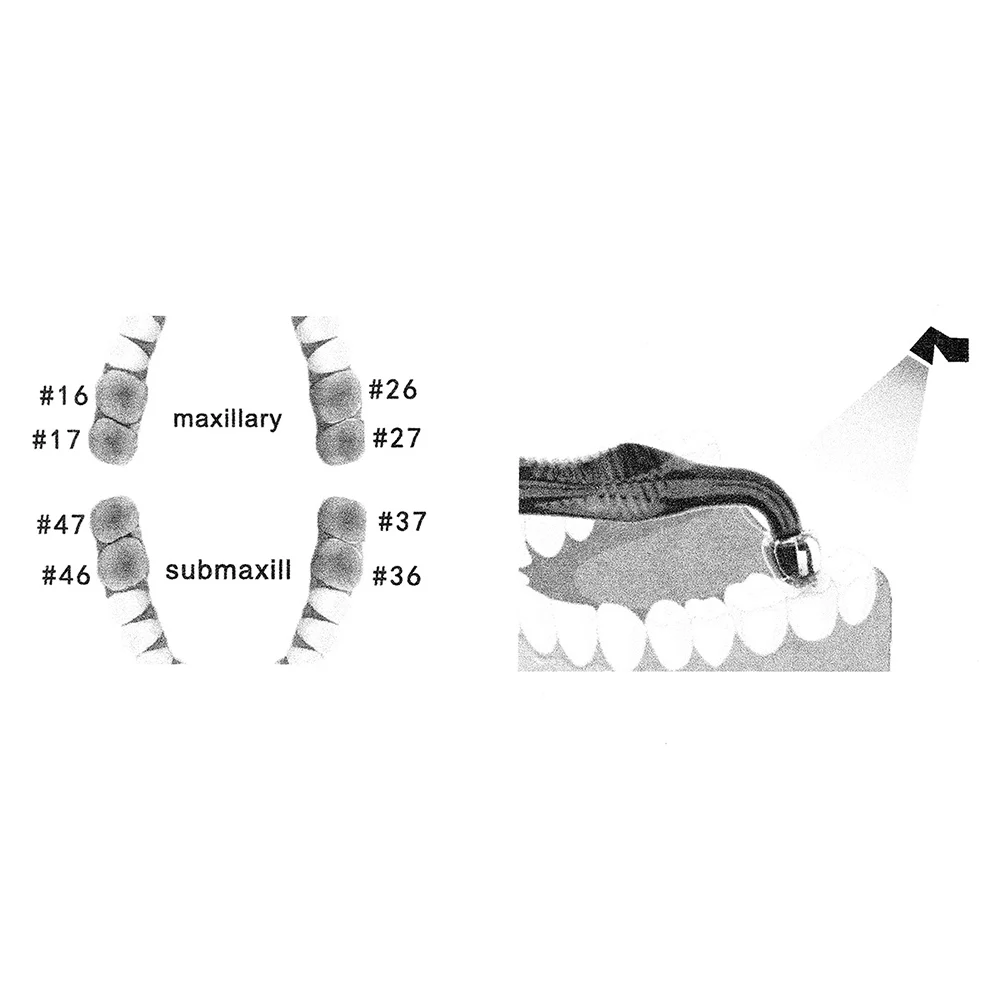 Набор для 3D-печати эстетическ – обзор и цена 3D Printing Orthodontics