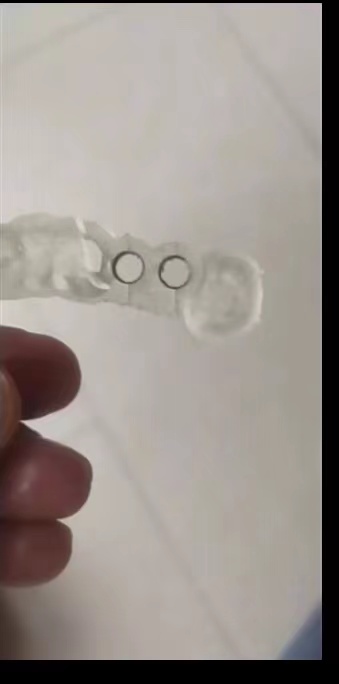 Стоматологический 3D-принтер и – обзор и цена 3D Printing Dental