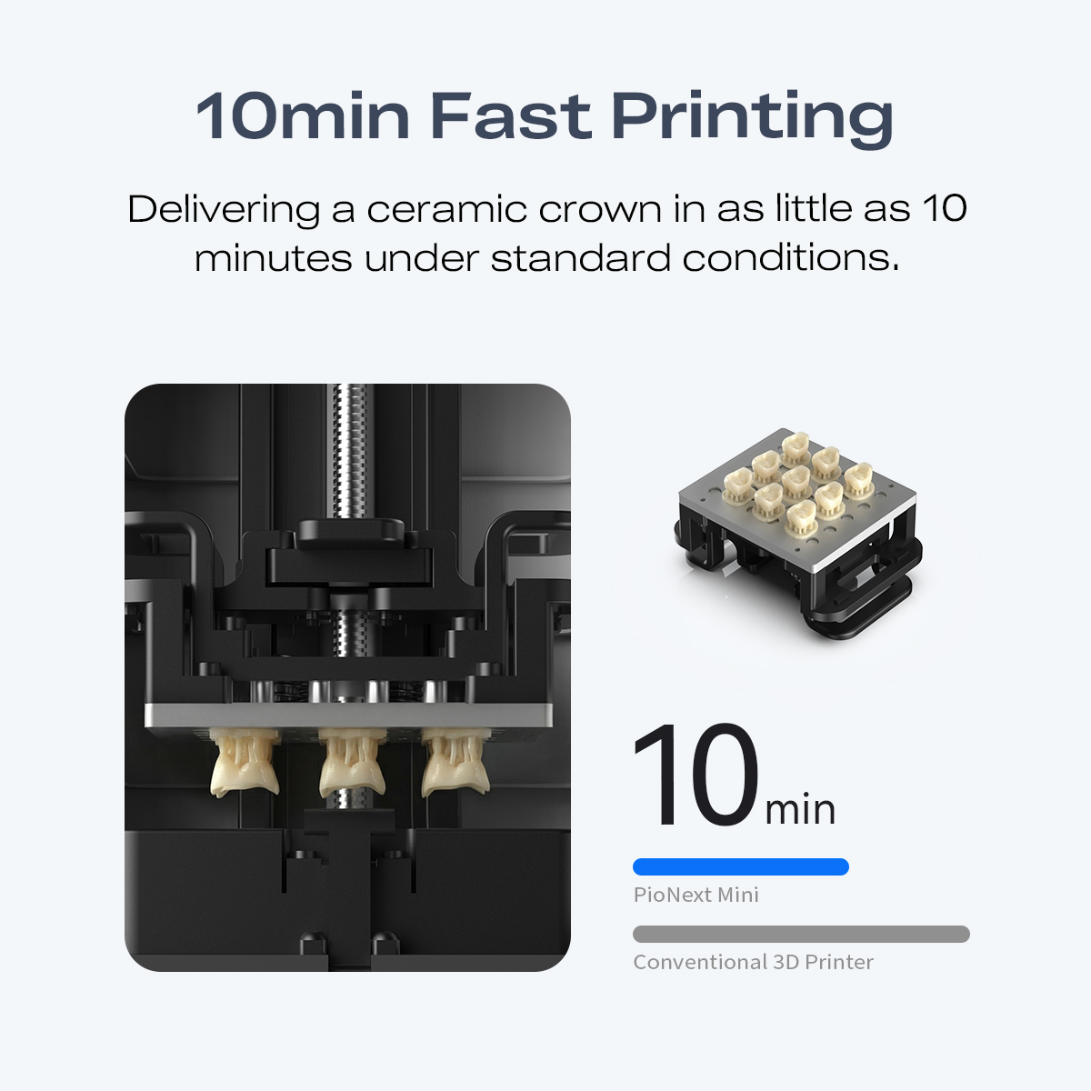 Миниатюрный высокоточный 3D-пр – обзор и цена 3D Printing Orthodontics