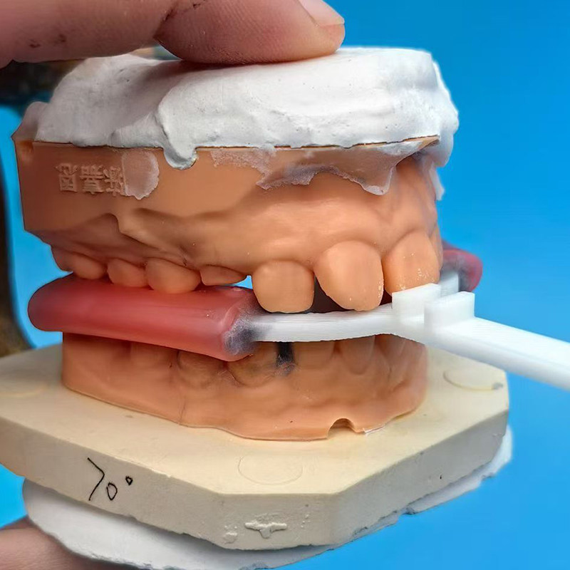 10 шт./упак. Зубные вилки для  – обзор и цена 3D Printing Orthodontics