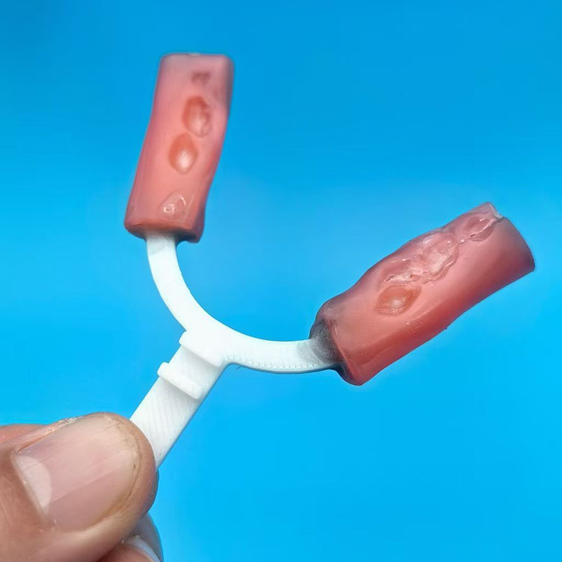 10 шт./упак. Зубные вилки для  – обзор и цена 3D Printing Orthodontics