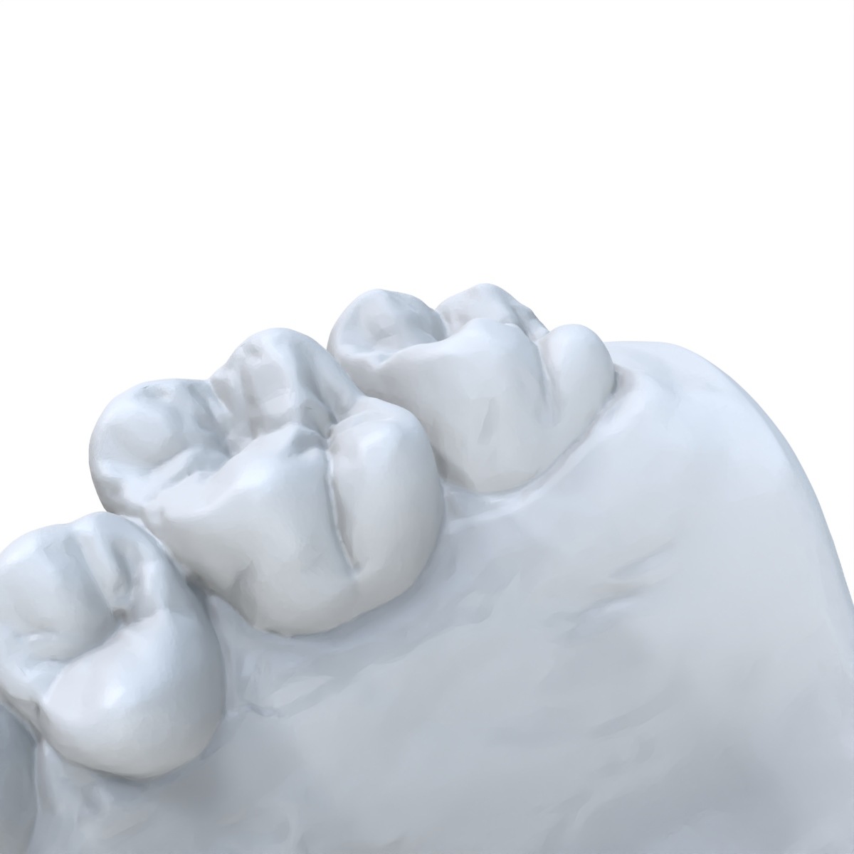 1 шт. стоматологическая модель – обзор и цена 3D Printing Dental