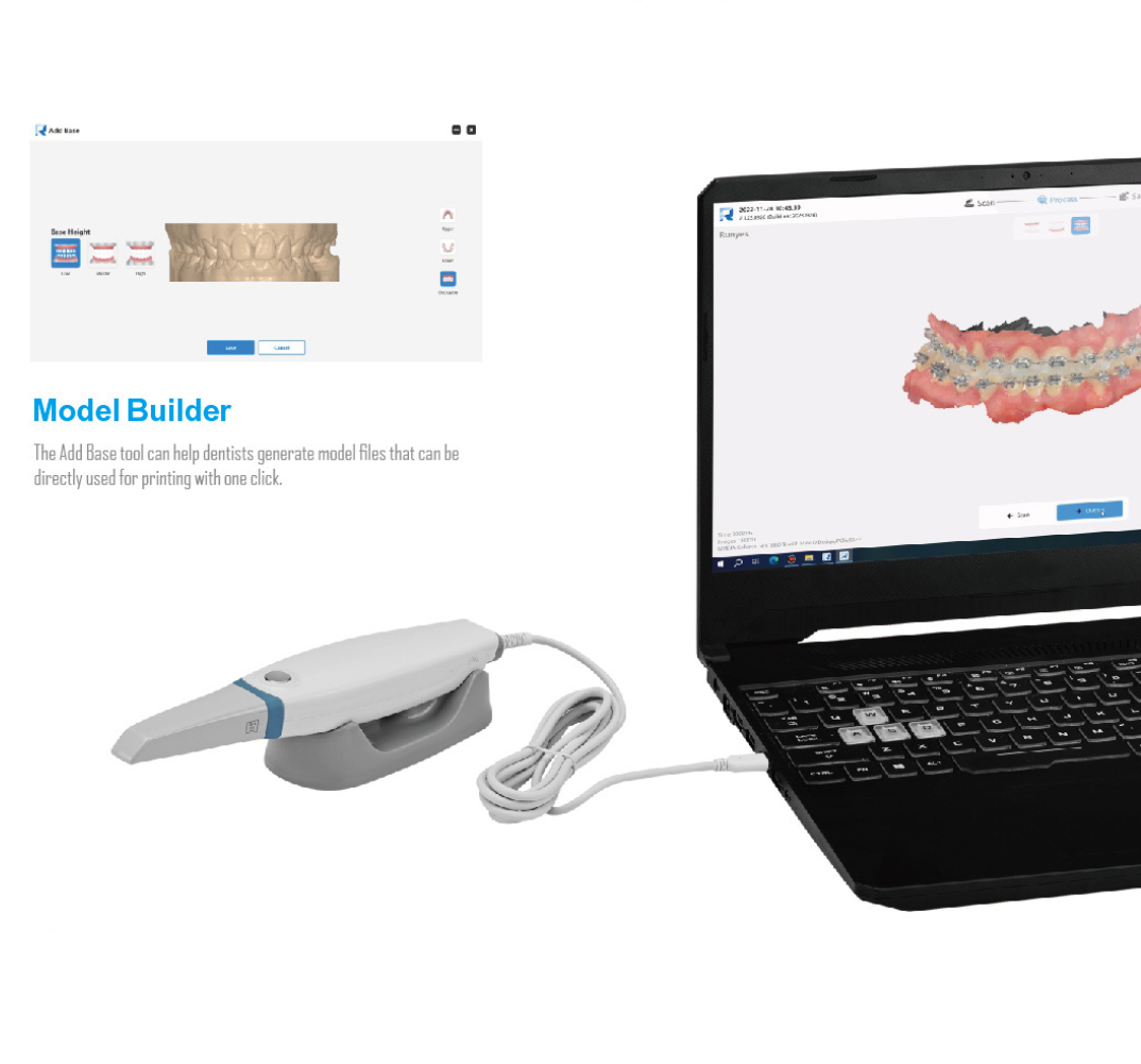 2026 НОВЫЙ стоматологический в – обзор и цена 3D Printing Dental